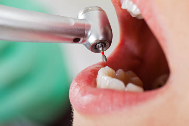 Best Emergency Dentist for Lost Fillings or Crowns in Trappe, PA